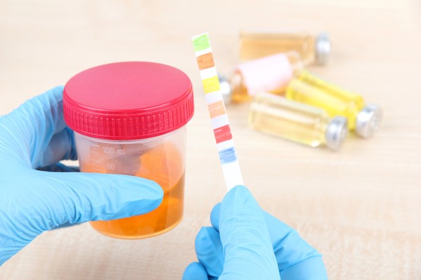 анализ мочи.jpg анализ мочи.jpg